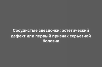 Сосудистые звездочки: эстетический дефект или первый признак серьезной болезни